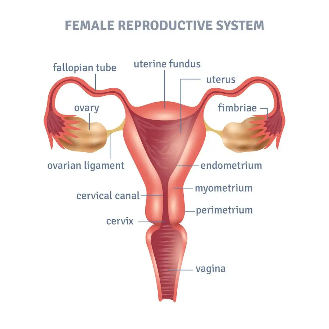 Diagram of the female reproductive tract showing the pathway of gonorrhea from cervix to fallopian tubes